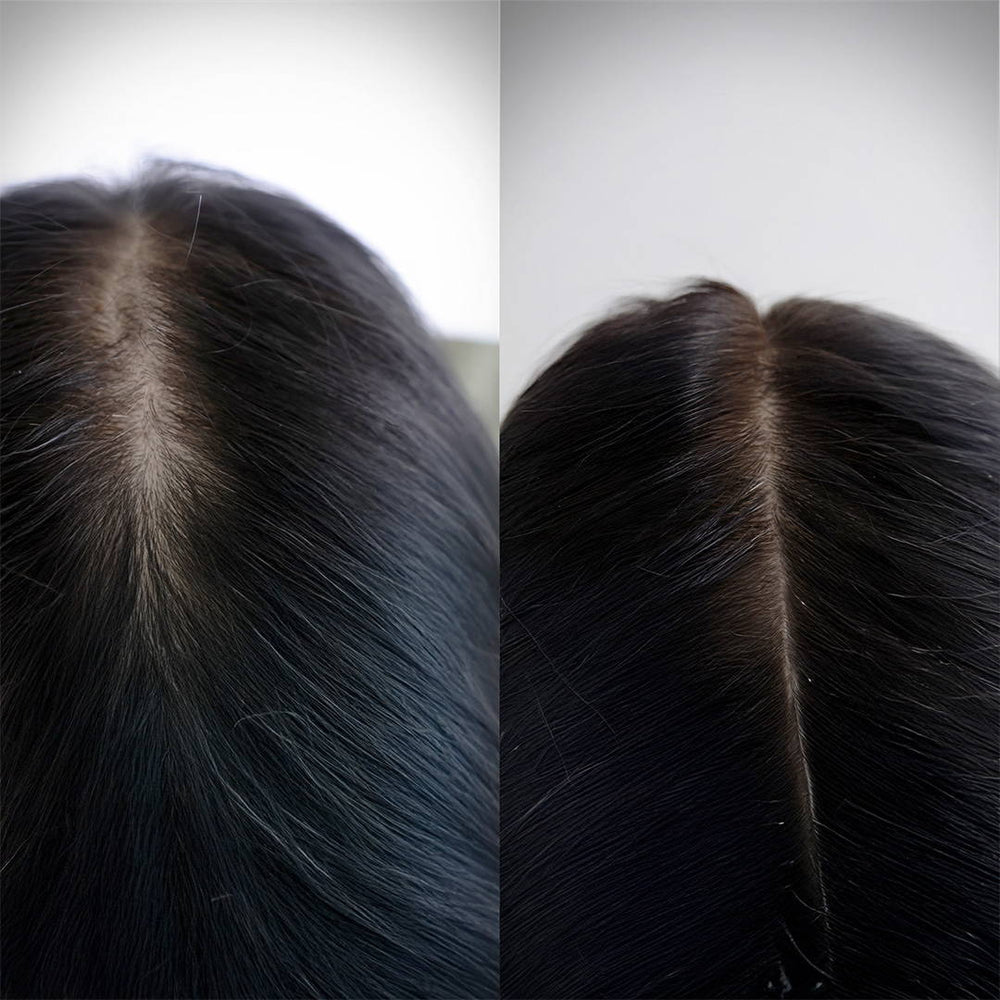Scalpsense Hydra Soothe combo pack of 5 with shampoo, conditioner, and serum for soothing scalp and reducing hair fall